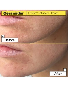 Dr.Jart_Ceramidin_Ectoin-Infused_1767010288_0.jpg 2